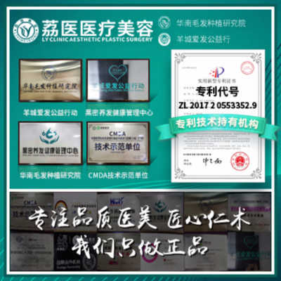 广州荔医植发怎么样，医院正规吗？技术优势揭秘，“魔发”指南！