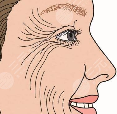 深圳乐美医疗美容门诊部怎么样？整形医生信息|面部除皱案例