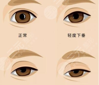 沧州奥拉克整形医院价格表一览曝光